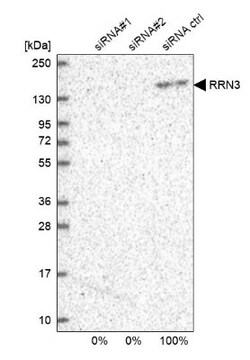 RRN3 Antibody, Novus Biologicals 0.1mL; Unlabeled:Antibodies, Polyclonal